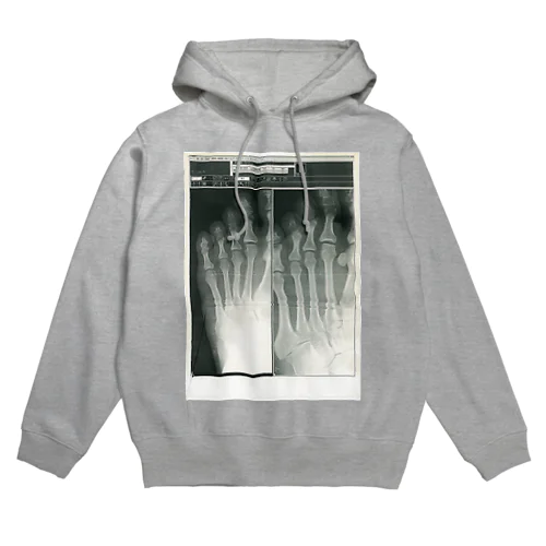 X-ray step Hoodie