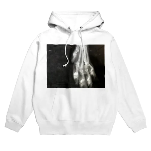 アポロ足怪我レントゲン Hoodie