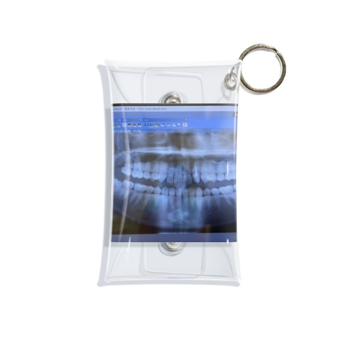 歯レントゲン2022年11月 Mini Clear Multipurpose Case