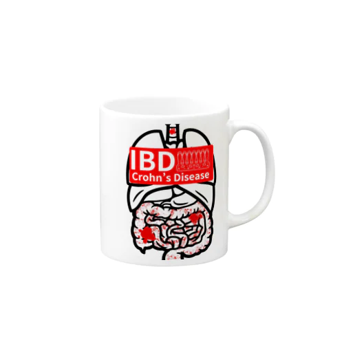 クローン病患者が作るIBDシリーズ Mug