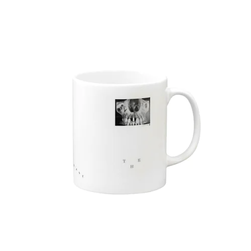 THE implant2 Mug