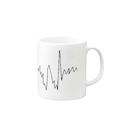 心電図 Mug