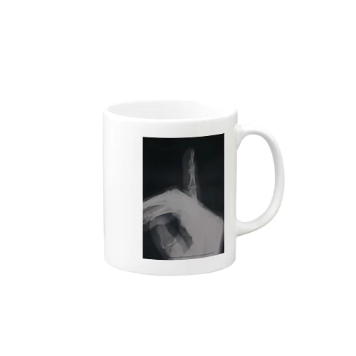 骨折 fracture  Mug