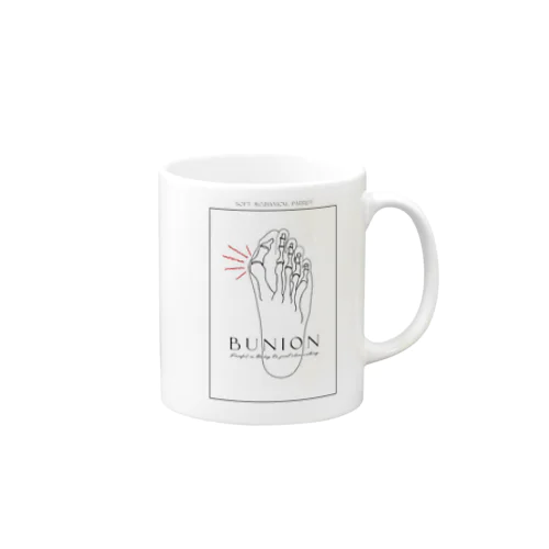 オシャレな外反母趾 Mug