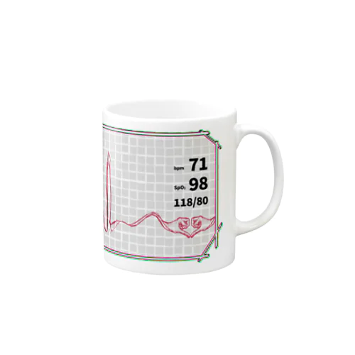 心電図 Mug