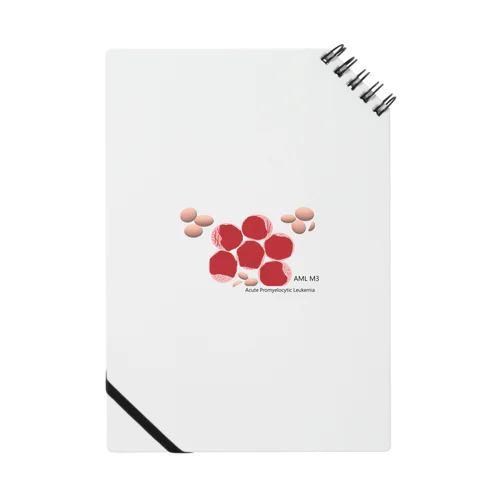 Acute Promyelocytic Leukemia Notebook