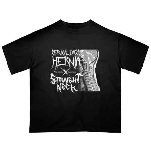 頸椎椎間板ヘルニア＆ストレートネック 対バンTシャツ Oversized T-Shirt