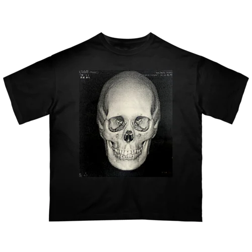折れた前歯の行方をまだ私は知らない Oversized T-Shirt
