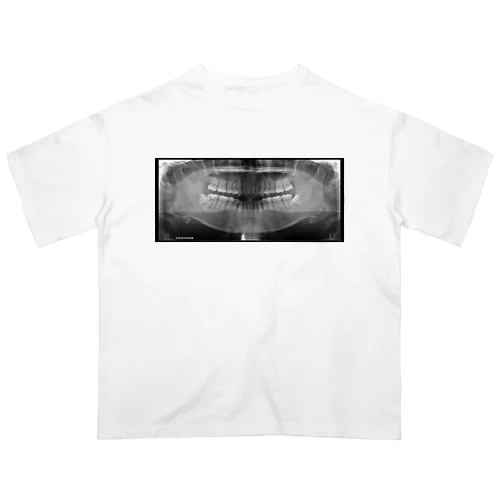 X-ray of teeth(歯のレントゲン) オーバーサイズTシャツ