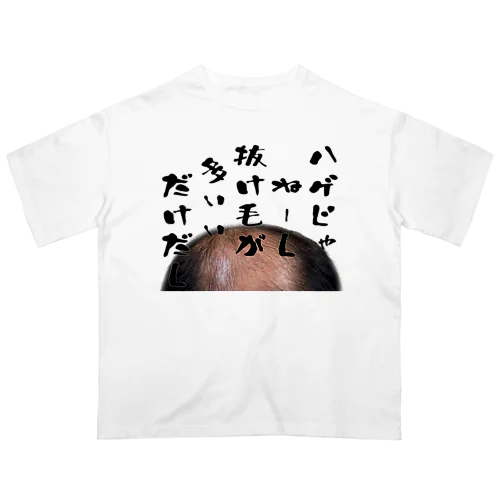 ハゲじゃねーし オーバーサイズTシャツ