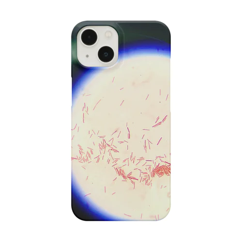 Gram-negative bacilli Micrograph Smartphone Case