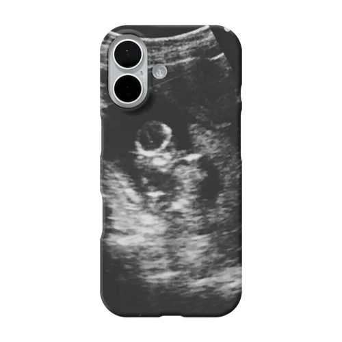 -6ヶ月のえださこ iPhone Smartphone Case