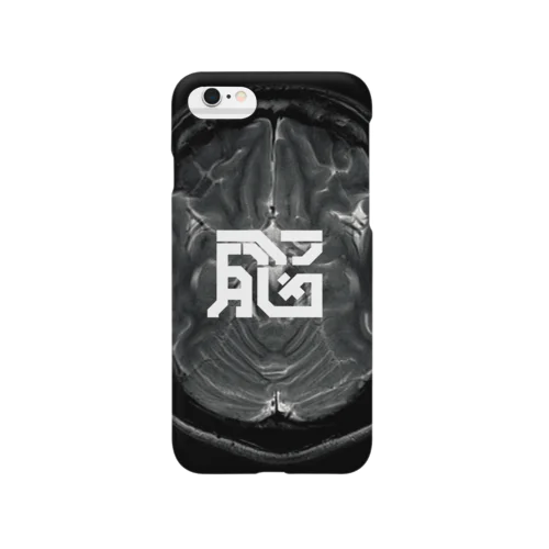 脳のMRI Smartphone Case