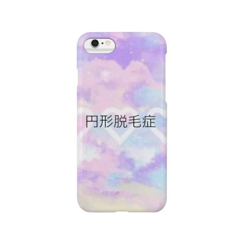 円形脱毛症(ゆめかわ) Smartphone Case