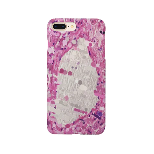 Pathology1 Smartphone Case