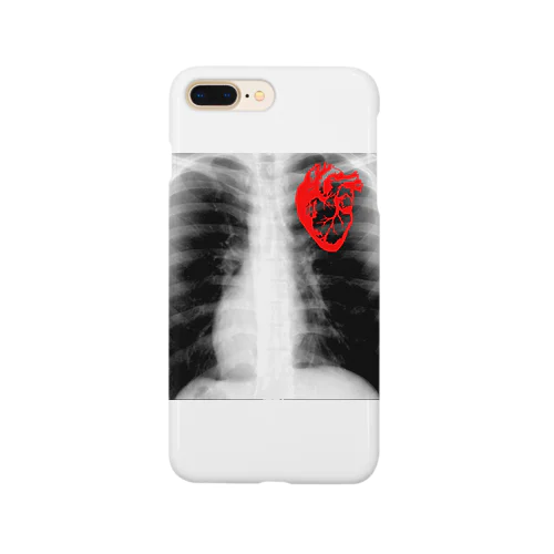 X-ray Smartphone Case