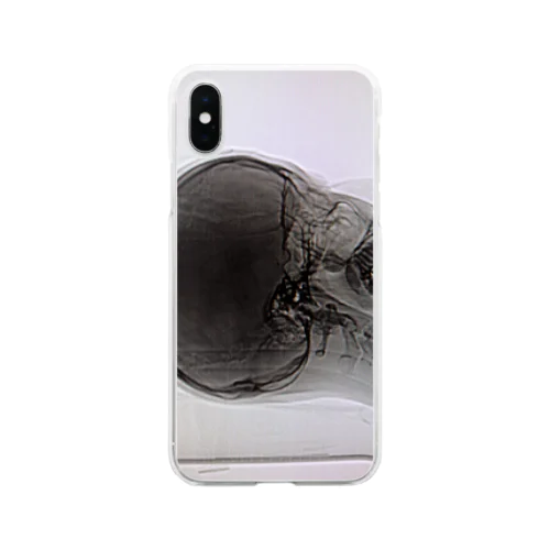 超個人情報 Soft Clear Smartphone Case