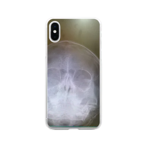 レントゲン Soft Clear Smartphone Case