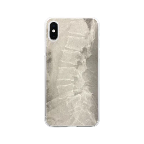 腰痛レントゲンくん Soft Clear Smartphone Case