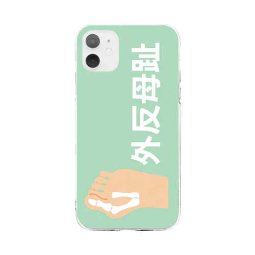 外反母趾 Soft Clear Smartphone Case