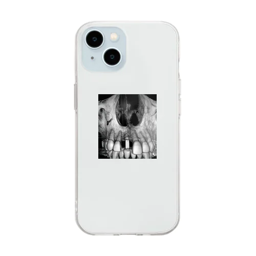 THE implant Soft Clear Smartphone Case