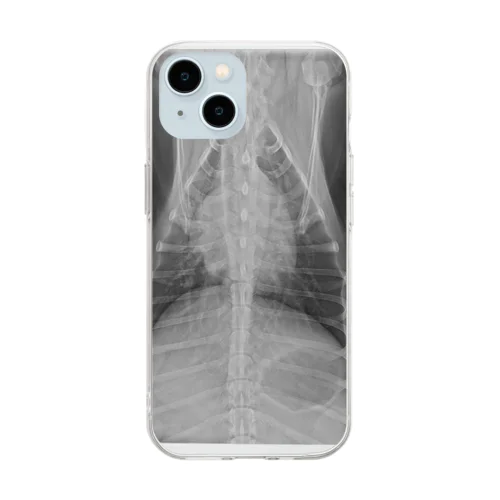 ティアラの胸部 Soft Clear Smartphone Case