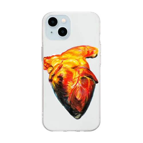 発作性上室性頻脈 Soft Clear Smartphone Case