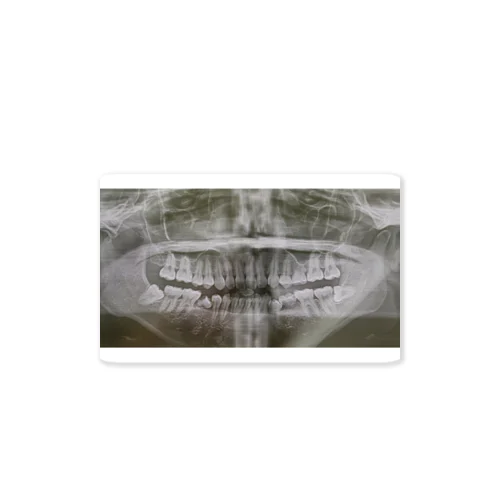 LunaLolly's sukesuke dental x-ray Sticker