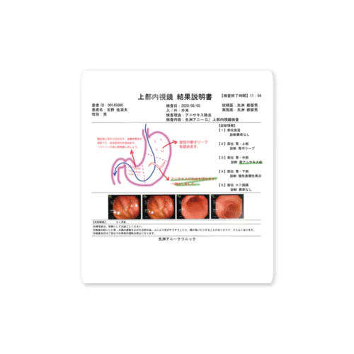 アニサキス摘出記念グッズ Sticker