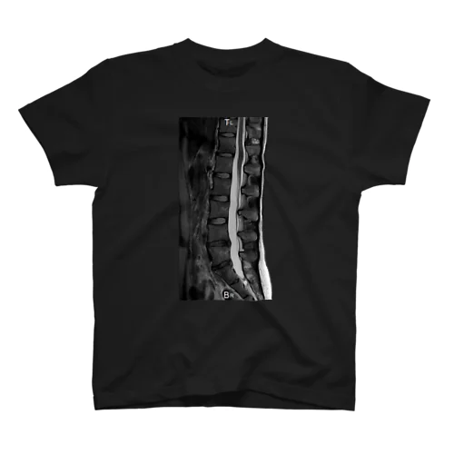 腰椎椎間板ヘルニアMRI記念Tシャツ スタンダードTシャツ