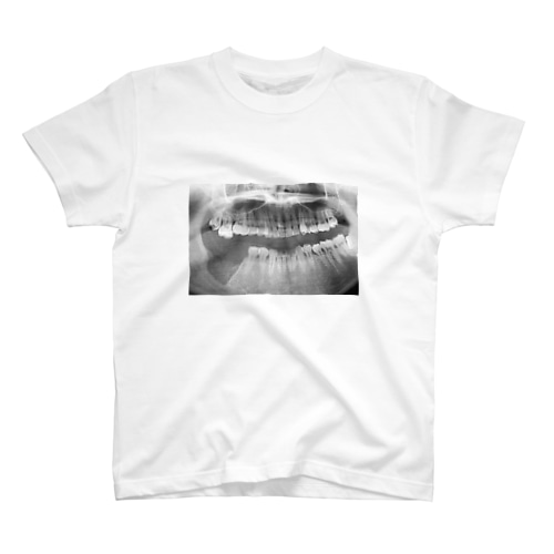 歯と歯茎摘出レントゲン Regular Fit T-Shirt