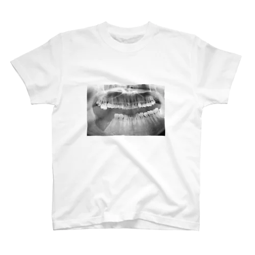 歯と歯茎摘出レントゲン スタンダードTシャツ