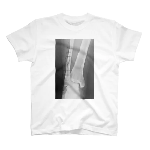 Broken Leg Regular Fit T-Shirt