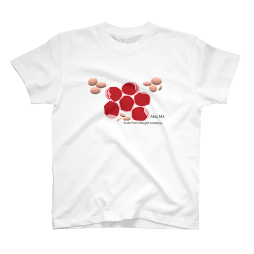 Acute Promyelocytic Leukemia スタンダードTシャツ