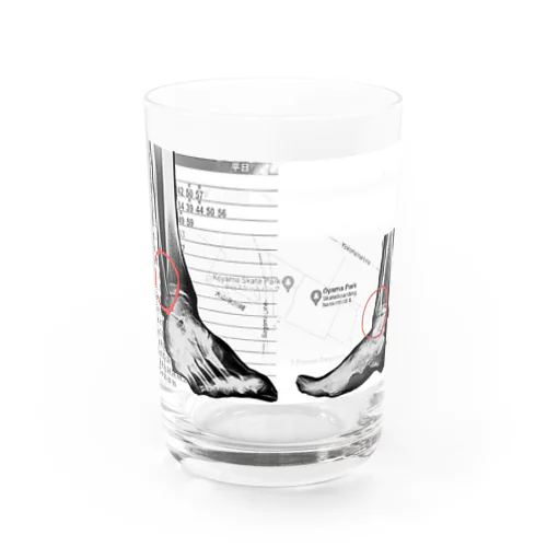 骨折したワシのレントゲン Water Glass