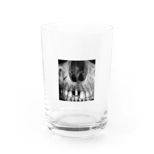 THE implant Water Glass