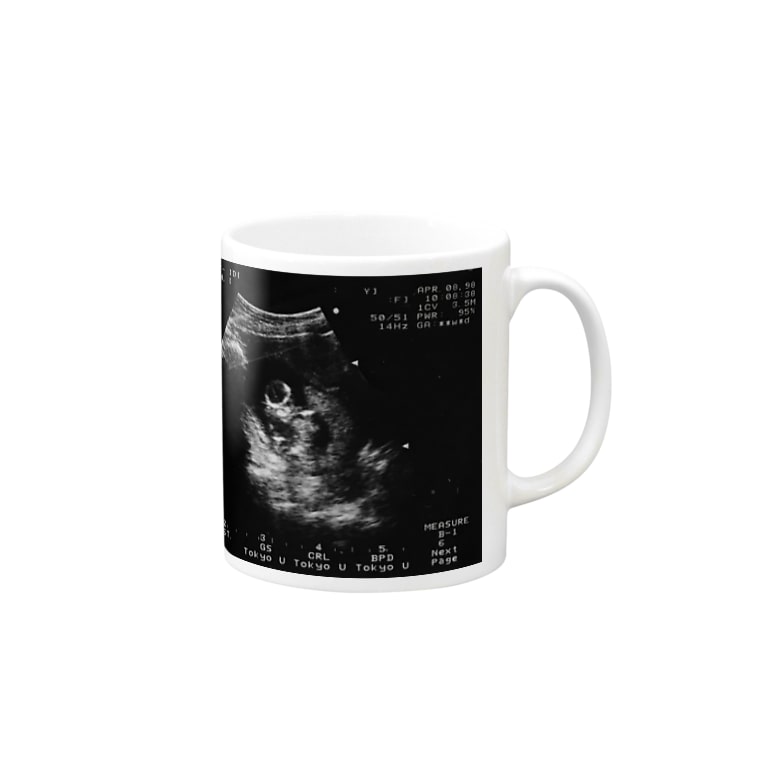 6ヶ月のえださこ フザリウム Edasako のマグカップ通販 Suzuri スズリ 6ヶ月のえださこ フザリウム Edasako のマグカップ通販 Suzuri スズリ